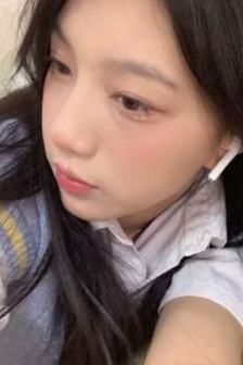 女性肛瘘图片大曝光